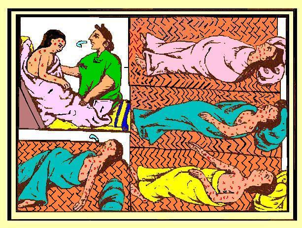 The Aztecs were utterly unprepared for the vicious wave of smallpox