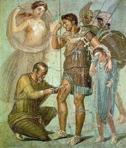 A Roman Soldier having an Arrow removed, depicted on an ancient mural. Wikimedia Commons / Sydb101 / CC BY-SA 4.0