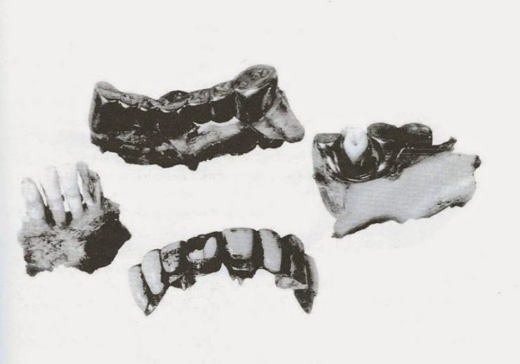 Hitler’s teeth