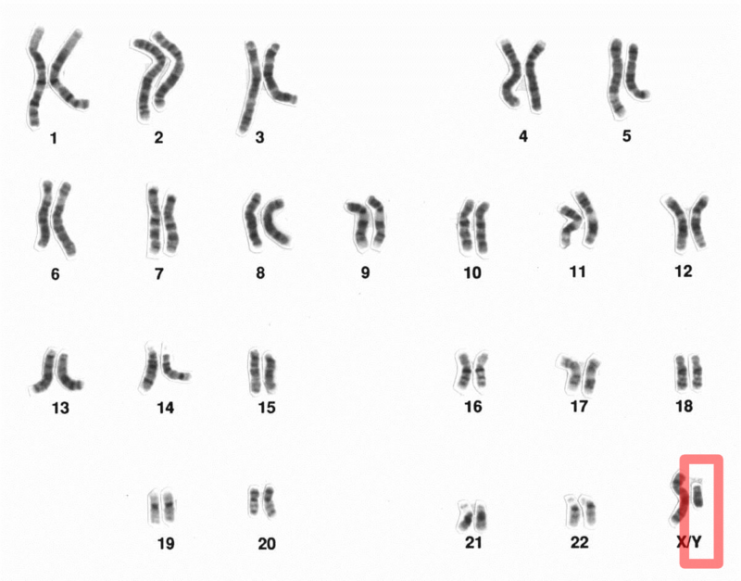 Human male Karyotype after G-banding. Y chromosome highlighted