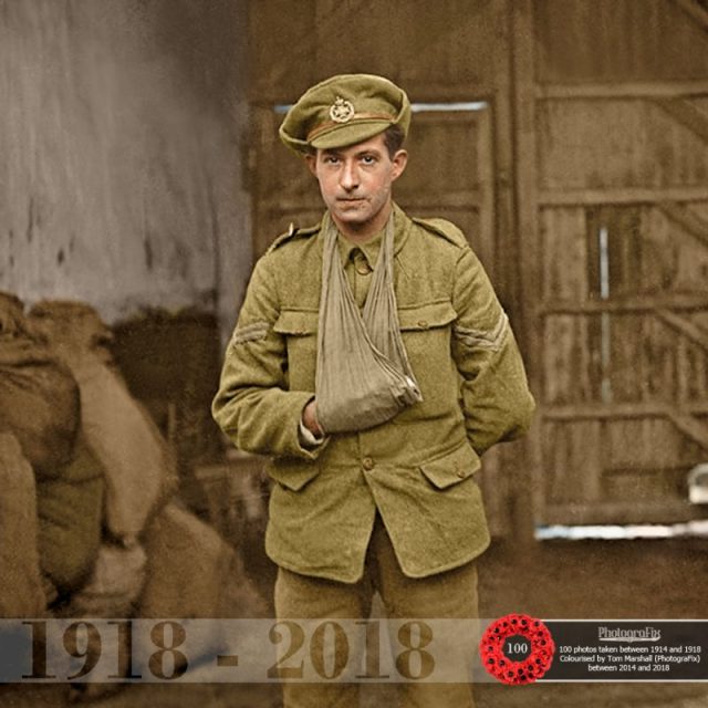 44. An unknown soldier (possibly of the Leeds Rifles) sporting an injured hand, photographed at Vignacourt, France. Original image courtesy of Ross Coulthart, author of ‘The Lost Tommies’ & The Kerry Stokes Collection – Louis & Antoinette Thuillier.