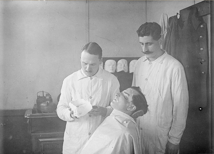 The Development of Reconstructive Plastic Surgery during the First World War The plaster mould is removed from the patient’s face by Captain Francis Derwent Wood, 3rd London General Hospital.