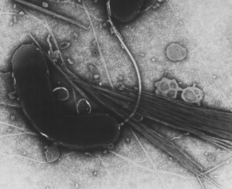 Vibrio cholerae, the bacterium that causes cholera.