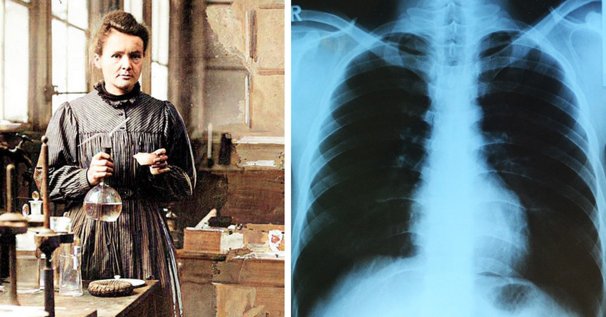 Marie Curie holding a vial in her laboratory + a colourized X-ray of a human chest