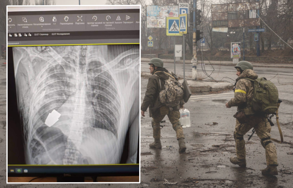 Ukrainian soldiers walking down a street + X-ray of a live grenade in a Ukrainian soldier's chest